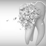 Efectividad y aplicación del ozono en odontología – revisión en endodoncia