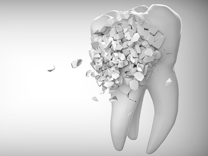 Efectividad y aplicación del ozono en odontología – revisión en endodoncia