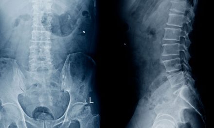 Spondylodiscitis and ozone therapy. Case report