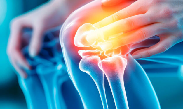 Treatment of gonarthrosis secondary to gonarthrosis with intra-articular ozone. Case presentation.