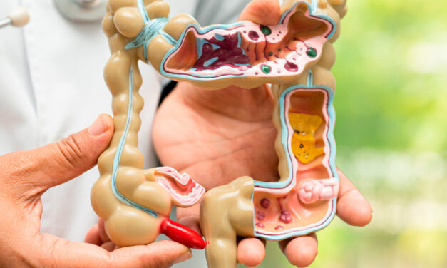 Presence of intestinal candida in autistic children and the therapeutic alternative associated with ozone therapy.  Pámanes M., Rafael Clínica Siloe Forever Ageless, Nuevo Léon, México