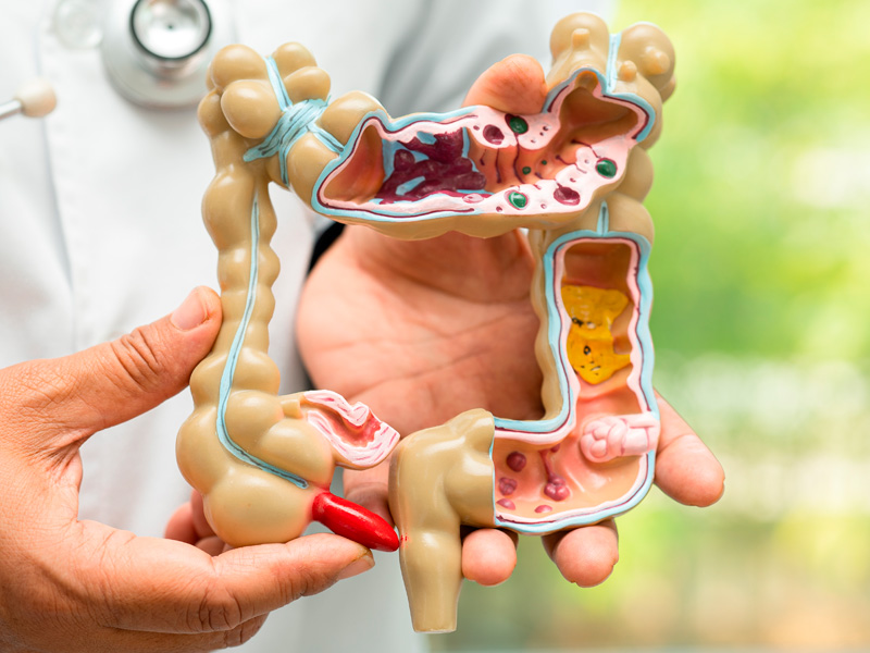 Presencia de cándida intestinal en niños autistas y la alternativa terapéutica asociada a la ozonoterapia